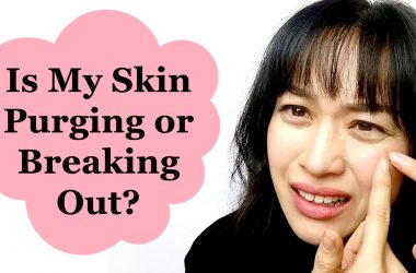 PURGING VS BREAKOUTS: WHEN TO DITCH YOUR SKINCARE
