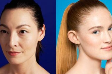 The Difference Between Adult Acne And Teen Acne