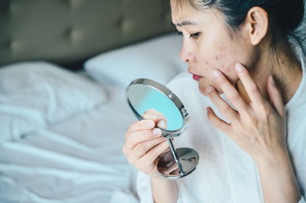 How Do Rejuvenating Set Treat pimples