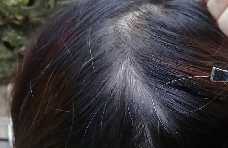 Does Pulling a White Hair Cause More White Hair To Grow?