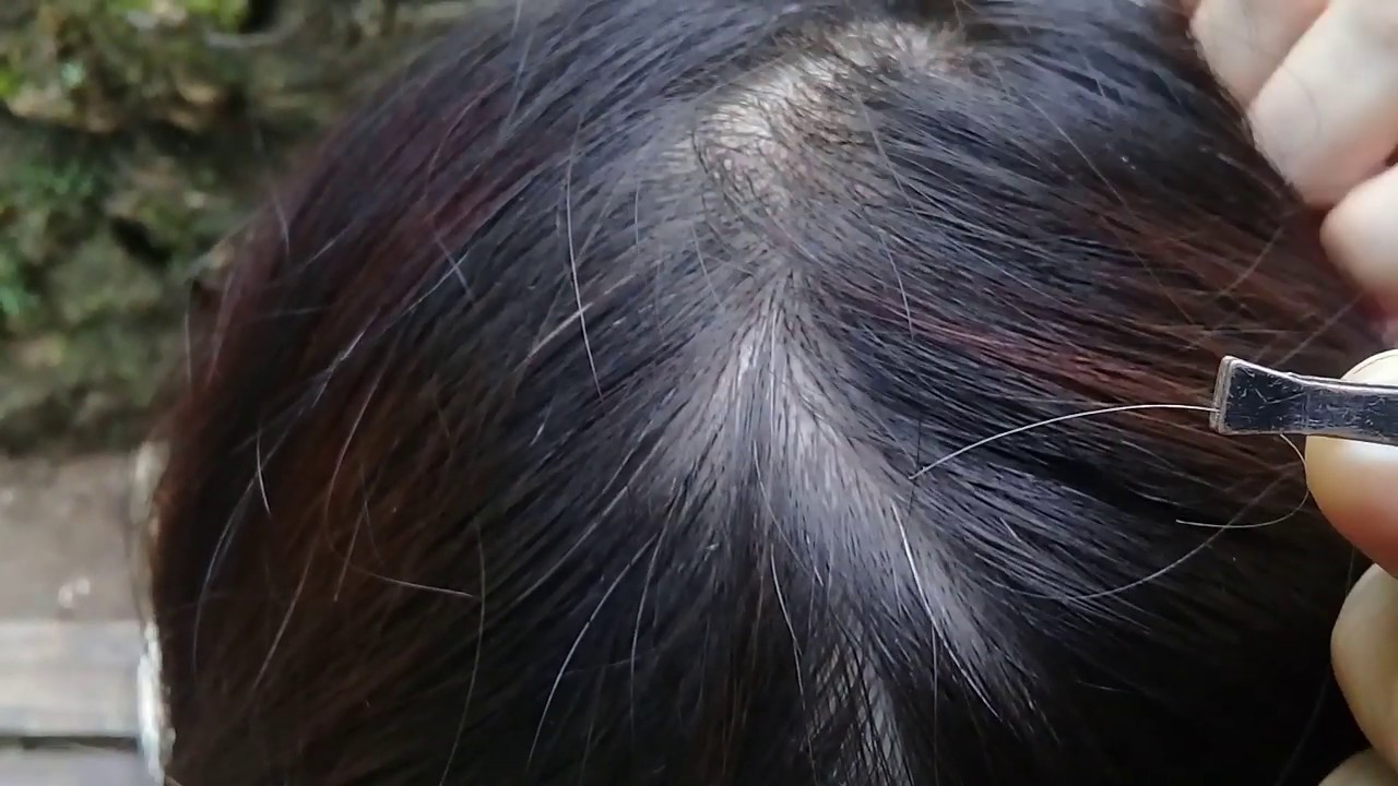 Does Pulling a White Hair Cause More White Hair To Grow?