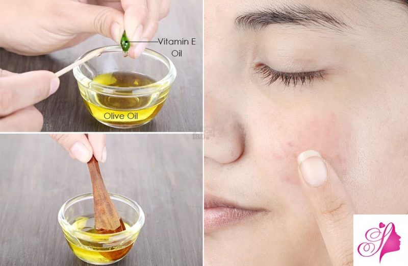 How To Use Vitamin E On Face