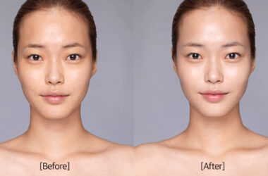 gluta whitening lazy cream before and after