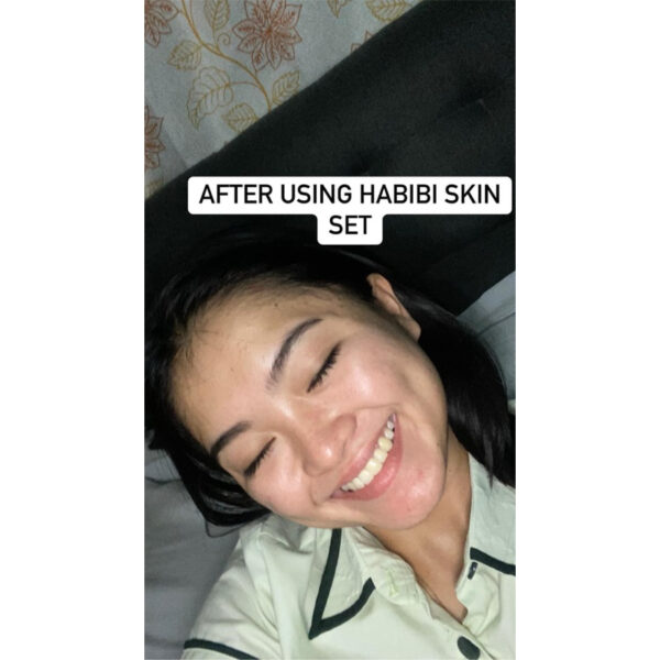 After using Habibi Skin Glowing Facial Set