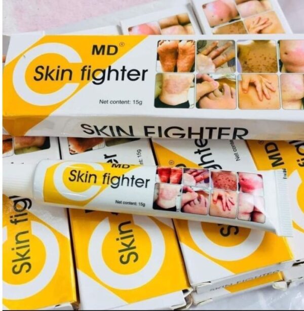 ON HAND MD Skin Fighter Cream for Skin Allergies, Skin Itching 15g & 35g