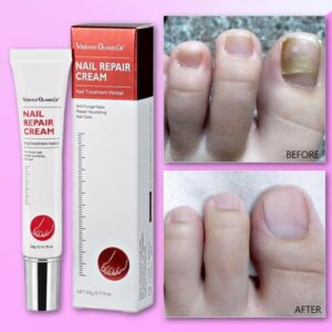 Vibrant Glamour Nail Repair Cream – Anti Fungal Nails Repair Nourishing- 20g