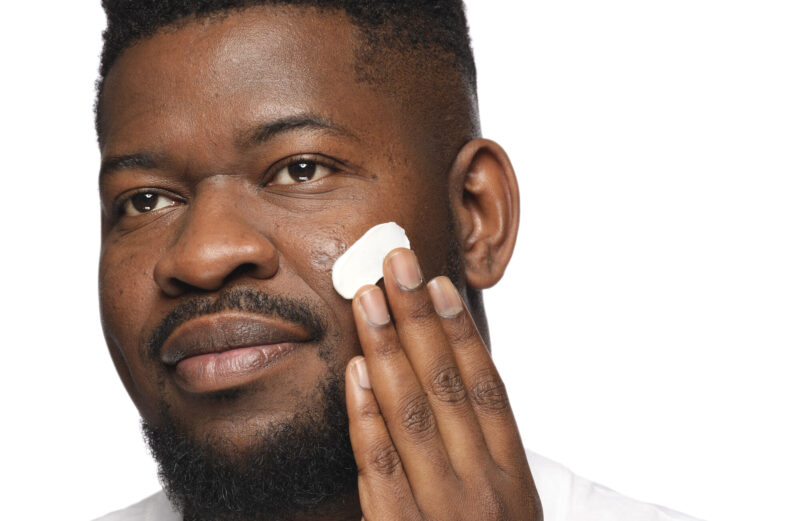 Pigmenting Problems? Here’s How to Address Common Causes of Hyperpigmentation