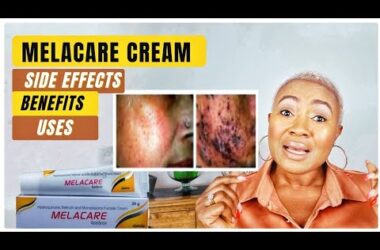 MELACARE CREAM & SKIN WHITENING: HOW TO USE, BENEFITS, & SIDE EFFECTS