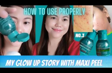 How to get rid from acne faster, I TRIED MAXIPEEL VARIANT NO.3. See what happened Before and After