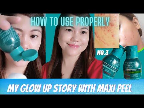 How to get rid from acne faster, I TRIED MAXIPEEL VARIANT NO.3. See what happened Before and After